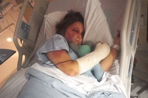 kirra hart full video|Teen victim of brutal alleged bashing speaks out about horrific